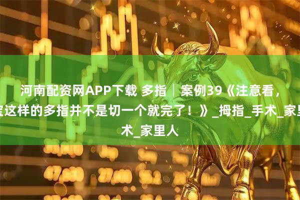 河南配资网APP下载 多指│案例39《注意看,宝宝这样的多指并不是切一个就完了!》_拇指_手术_家里人